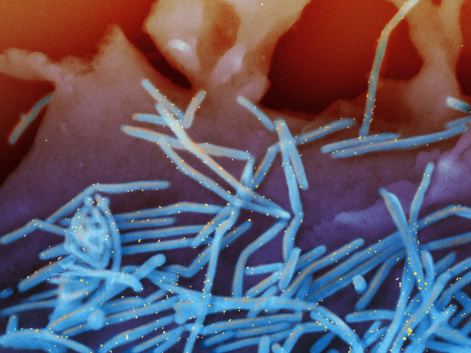 Imagem de microscopia eletrônica do vírus sincicial respiratório humano